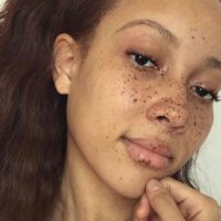 Freckles On Cute Black Woman