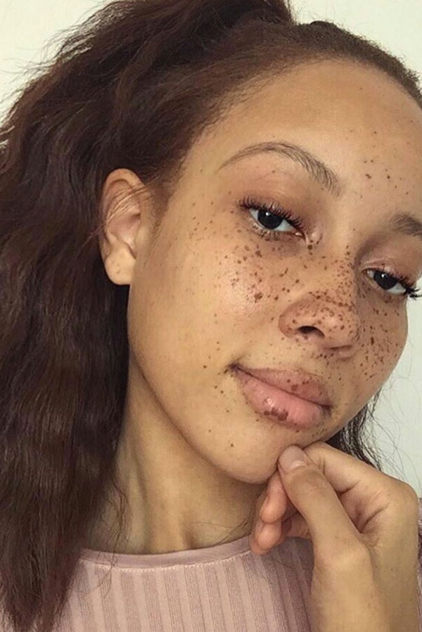Freckles On Cute Black Woman